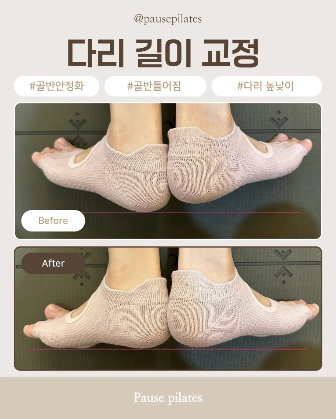 포즈필라테스 비포애프터 — 다리 길이 교정