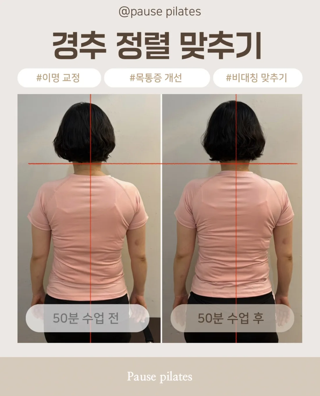 포즈필라테스 비포애프터 — 경추 정렬 · 50분 수업 전후
